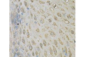 Immunohistochemistry of paraffin-embedded Human esophagus using ALDH3A1 Polyclonal Antibody at dilution of 1:100 (40x lens). (ALDH3A1 anticorps)
