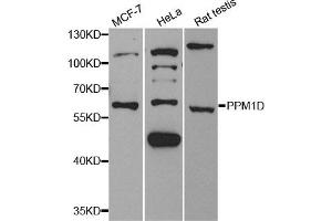 Western Blotting (WB) image for anti-Protein Phosphatase, Mg2+/Mn2+ Dependent, 1D (PPM1D) antibody (ABIN1882331) (PPM1D anticorps)
