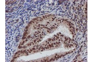 Image no. 9 for anti-ATR Interacting Protein (ATRIP) (AA 42-309) antibody (ABIN1491507)