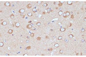 Immunohistochemistry of paraffin-embedded Mouse brain using COPG2 Polyclonal Antibody at dilution of 1:100 (40x lens).