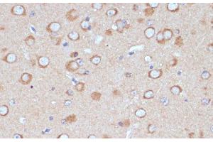Immunohistochemistry of paraffin-embedded Mouse brain using COPG2 Polyclonal Antibody at dilution of 1:100 (40x lens). (COPG2 anticorps)