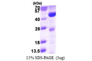 SDS-PAGE (SDS) image for Acyl-CoA Dehydrogenase, Long Chain (ACADL) (AA 31-430) protein (His tag) (ABIN667975)