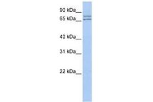 Image no. 1 for anti-DEAD (Asp-Glu-Ala-Asp) Box Polypeptide 27 (DDX27) (AA 35-84) antibody (ABIN6742687)