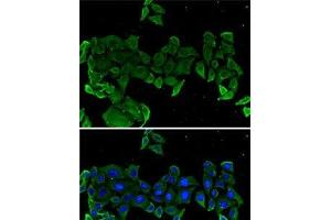 Immunofluorescence analysis of U2OS cells using COMP Polyclonal Antibody (COMP anticorps)