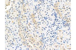 ABIN6260811 and ABIN6272991 at 1/100 staining Rat kidney tissue by IHC-P. (CHMP2A anticorps  (Internal Region))