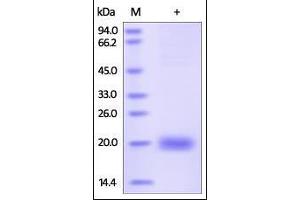 Human SECTM1, His Tag on SDS-PAGE under reducing (R) condition. (SECTM1 Protein (AA 29-145) (His tag))