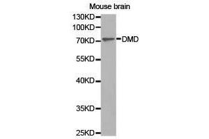 Western Blotting (WB) image for anti-Dystrophin (DMD) antibody (ABIN1872293) (Dystrophin anticorps)