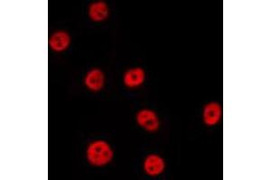 ABIN6274041 staining Hela by IF/ICC. (PTBP2 anticorps  (Internal Region))