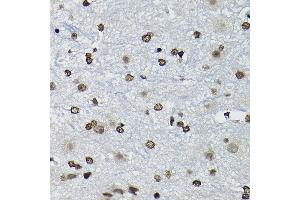 Immunohistochemistry of paraffin-embedded mouse spinal cord using Cyclin K Rabbit pAb (ABIN6128996, ABIN6138098, ABIN6138099 and ABIN6214445) at dilution of 1:100 (40x lens).