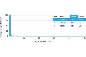 Analysis of Protein Array containing more than 19,000 full-length human proteins using Uroplakin 1B Mouse Monoclonal Antibody (UPK1B/3102) Z- and S- Score: The Z-score represents the strength of a signal that a monoclonal antibody (MAb) (in combination with a fluorescently-tagged anti-IgG secondary antibody) produces when binding to a particular protein on the HuProtTM array. (Uroplakin 1B anticorps  (AA 109-229))