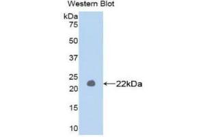Western Blotting (WB) image for anti-Matrix Metallopeptidase 1 (Interstitial Collagenase) (MMP1) (AA 98-275) antibody (Biotin) (ABIN1172278) (MMP1 anticorps  (AA 98-275) (Biotin))