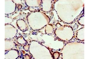 Immunohistochemistry of paraffin-embedded human thyroid tissue using ABIN7152570 at dilution of 1:100 (FUBP3 anticorps  (AA 65-260))
