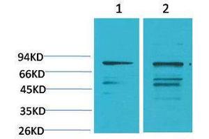 Western Blotting (WB) image for anti-Phosphoinositide 3 Kinase, p85 alpha (PI3K p85a) antibody (ABIN3181561) (PIK3R1 anticorps)