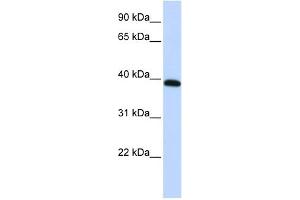 WB Suggested Anti-HOXA10 Antibody Titration:  0. (HOXA10 anticorps  (Middle Region))