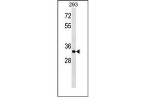 Western blot analysis of ELOVL4 Antibody (C-term) in 293 cell line lysates (35ug/lane). (ELOVL4 anticorps  (C-Term))