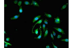 Immunofluorescent analysis of Hela cells using ABIN7163206 at dilution of 1:100 and Alexa Fluor 488-congugated AffiniPure Goat Anti-Rabbit IgG(H+L) (PIGA anticorps  (AA 443-484))