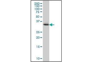 Western Blotting (WB) image for anti-Crystallin, mu (CRYM) (AA 215-315) antibody (ABIN614593) (CRYM anticorps  (AA 215-315))