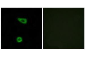 Immunofluorescence analysis of HuvEc cells, using TNAP2 antibody. (TNFAIP2 anticorps  (Internal Region))