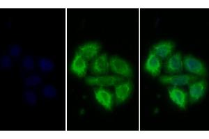 Detection of PRLR in Human MCF7 cell using Polyclonal Antibody to Prolactin Receptor (PRLR) (Prolactin Receptor anticorps  (AA 25-234))