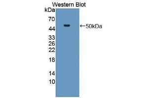 Western blot analysis of the recombinant protein. (HYAL1 anticorps  (AA 40-449))