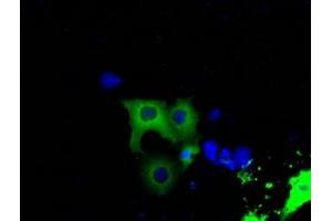 Image no. 5 for anti-Bruton Agammaglobulinemia tyrosine Kinase (BTK) antibody (ABIN1496973) (BTK anticorps)