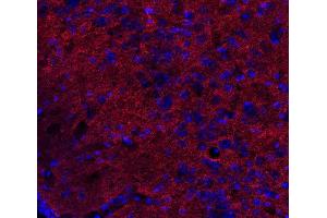Indirect immunostaining of PFA fixed mouse brain section (dilution 1 : 500; red).
