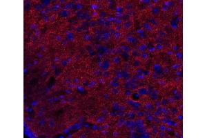 Indirect immunostaining of PFA fixed mouse brain section (dilution 1 : 500; red).