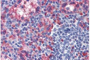 Human Spleen: Formalin-Fixed, Paraffin-Embedded (FFPE)