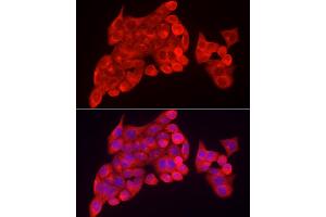 Immunofluorescence analysis of HeLa cells using INPP5K Rabbit pAb (ABIN6132112, ABIN6142473, ABIN6142474 and ABIN6223771) at dilution of 1:150 (40x lens). (INPP5K anticorps  (AA 149-448))