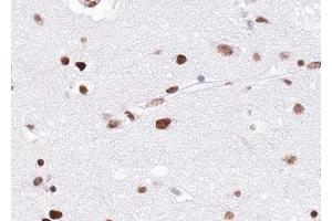 ABIN6268797 at 1/100 staining human brain tissue sections by IHC-P. (EZH1 anticorps  (Internal Region))