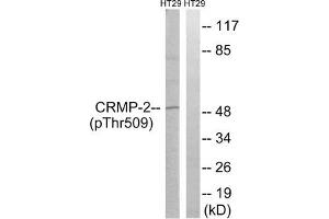 Western blot analysis of extracts from HT-29 cells treated with heat shock using CRMP-2 (Phospho-Thr509) Antibody.