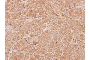IHC-P Image Immunohistochemical analysis of paraffin-embedded SW480 xenograft, using ZNHIT1, antibody at 1:500 dilution. (ZNHIT1 anticorps)