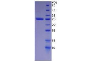SDS-PAGE analysis of Human GSTa2 Protein. (GSTa2 Protéine)