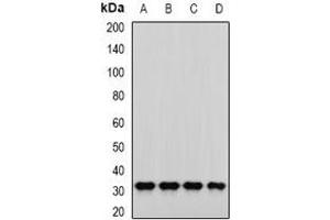 Western blot analysis of PNP expression in SKOV3 (A), MCF7 (B), mouse liver (C), mouse kidney (D) whole cell lysates. (PNP anticorps)