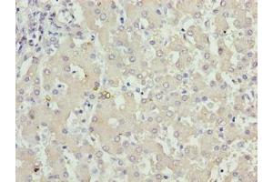 Immunohistochemistry of paraffin-embedded human liver tissue using ABIN7157483 at dilution of 1:100 (KHDC1 anticorps  (AA 74-237))