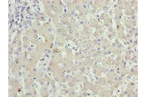 Immunohistochemistry of paraffin-embedded human liver tissue using ABIN7157483 at dilution of 1:100