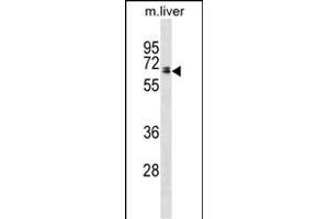 Rat Ggt1 Antibody (N-term) (ABIN1881372 and ABIN2838691) western blot analysis in mouse liver tissue lysates (35 μg/lane). (GGT1 anticorps  (N-Term))