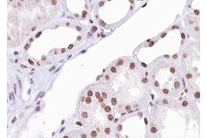 ABIN6267388 at 1/100 staining human Kidney tissue sections by IHC-P. (ATF2 anticorps  (pSer94, pSer112))