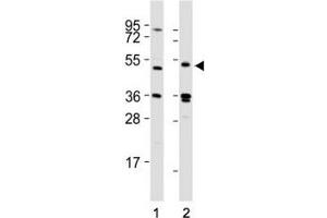Western blot testing of LAG3 antibody at 1:2000 dilution tested on lysates from Lane 1: 293T; 2: human spleen; Predicted molecular weight ~54 kDa. (LAG3 anticorps  (AA 103-132))