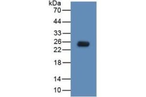 WB of Protein Standard: different control antibodies  against Highly purified E.