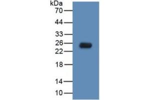 WB of Protein Standard: different control antibodies  against Highly purified E. (TLR5 Kit ELISA)
