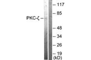Western blot analysis of extracts from NIH-3T3 cells, treated with PMA 125ng/ml 30', using PKC zeta (Ab-410) Antibody. (PKC zeta anticorps  (AA 376-425))