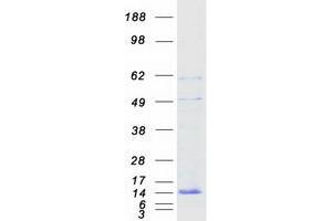 Validation with Western Blot
