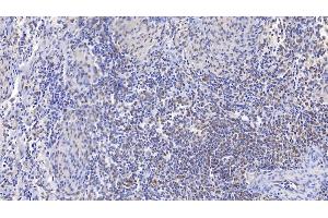 Detection of PSME3 in Human Spleen Tissue using Polyclonal Antibody to Proteasome Activator Subunit 3 (PSME3)