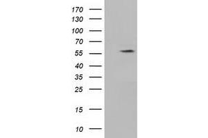 Western Blotting (WB) image for anti-Kelch-Like 2, Mayven (KLHL2) (AA 1-100), (AA 494-593) antibody (ABIN1490548) (KLHL2 anticorps  (AA 1-100, AA 494-593))