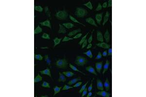 Immunofluorescence analysis of L929 cells using BMPR1B antibody (ABIN3022719, ABIN3022720, ABIN3022721, ABIN1512645 and ABIN6219169) at dilution of 1:100.