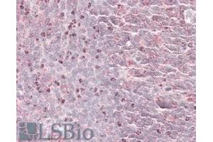 ABIN570940 (3. (Septin 6 anticorps  (Internal Region))