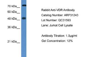 WB Suggested Anti-VDR Antibody   Titration: 1. (Vitamin D Receptor anticorps  (N-Term))