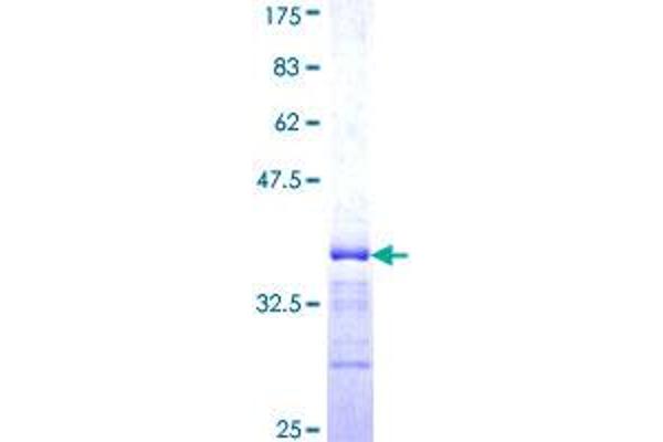 BICD1 Protein (AA 1-70) (GST tag)