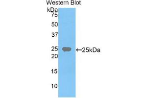 Western blot analysis of the recombinant protein. (FDFT1 anticorps  (AA 217-416))